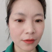 张碧英