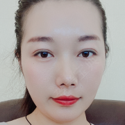 张笑